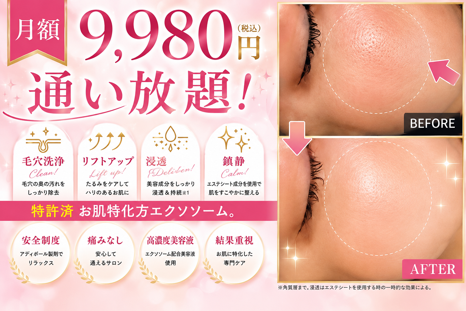 キャンペーンバナー